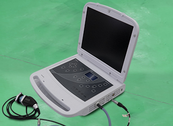 mobile endoscopy unit portable endoscopy system for screening