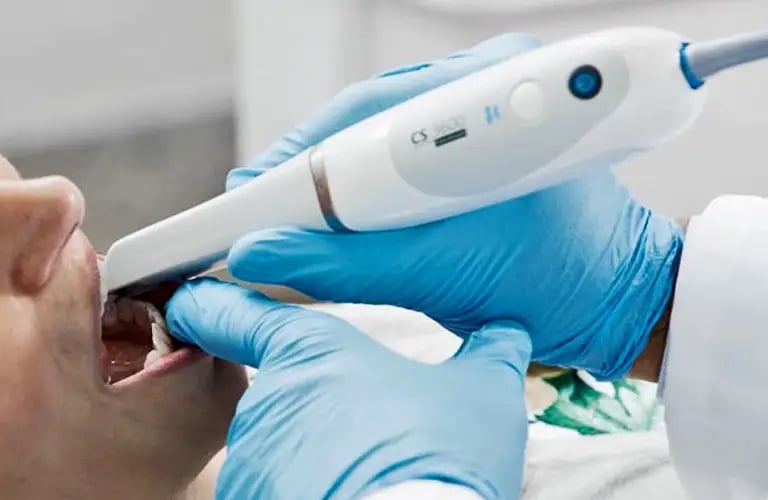 Scanner intraoral 3D: Diagnóstico preciso y modelos digitales, Dra. Marianela Sors, Puerto Madero.