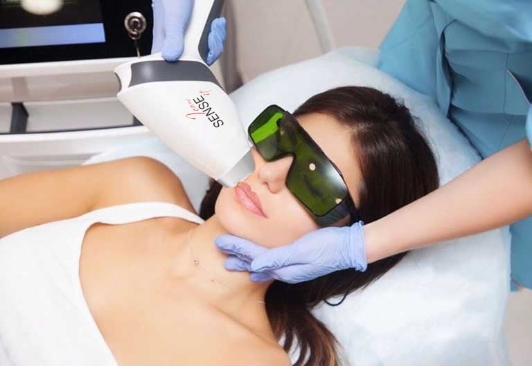 Epilazione laser al diodo viso a Riccione eseguita in centro estetico con trattamento professionale