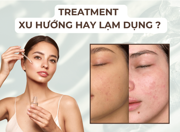 Treatment - Xu hướng hay lạm dụng