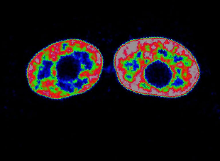 Microscopic view of two biological daughter cells presenting toroidal nuclei