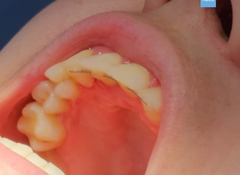 Paciente en silla de ortodoncia en Badajoz