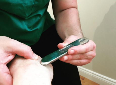 thérapeute pratiquant la technique Graston pour les adhérences de la main 