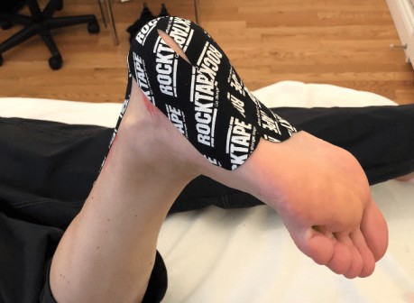 "Individu recevant une thérapie par bande kinésiologique (K-tape) à A.S. Sport Clinic, avec un thérapeute.