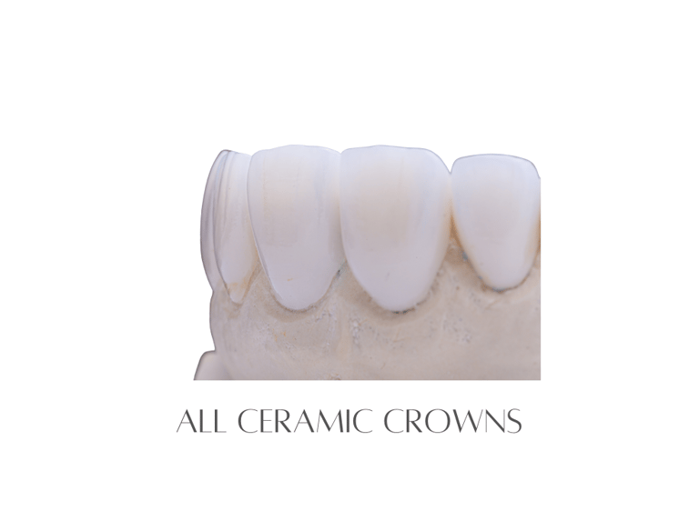 All Ceramic Crowns