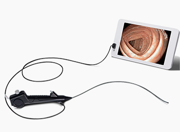 usb endoscope connect to phone