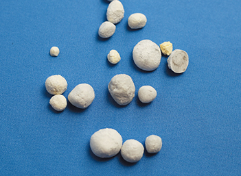 Stone Removal Practice