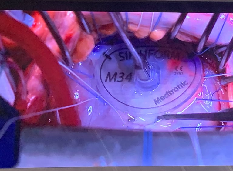 Heart Valve Repair Malta