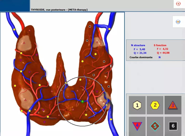 un écran d'ordinateur