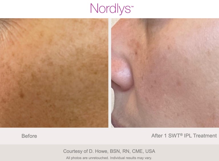 glowing and refreshed skin after rejuvenation treatment in Hamilton Ontario