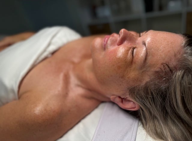 The Glow after a chemical peel. Chemical peel for hyperpigmentation.