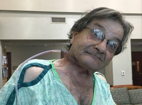 surgery for my cancer healing