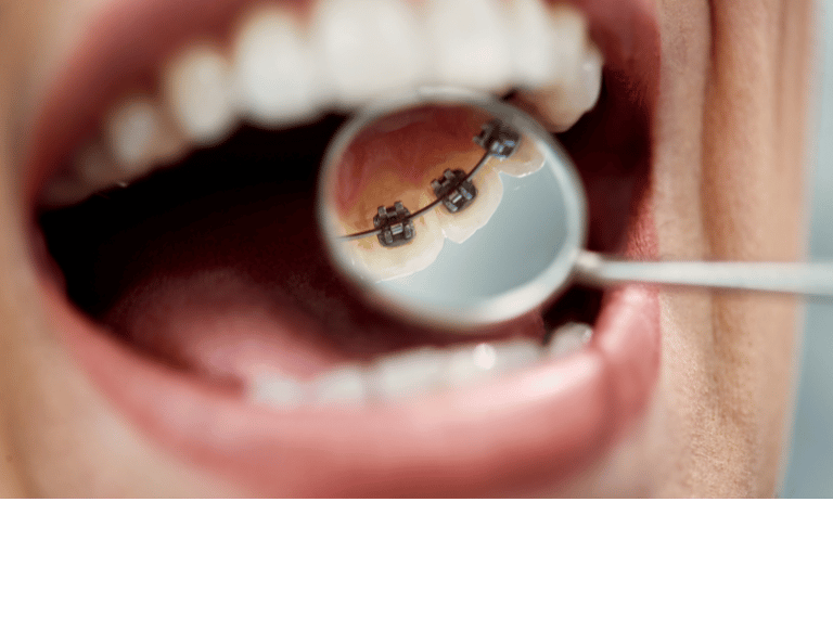 dr Katarzyna Januszewska - ortodonta Kłobuck