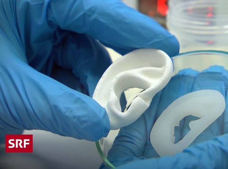 a person wearing gloves holding 3D printed ear and bioprinter ear