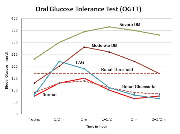 GTT curves