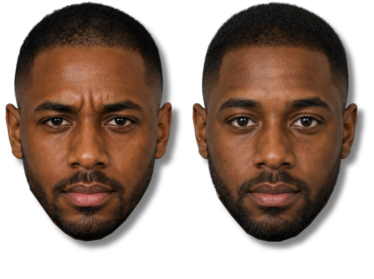 Side-by-side comparison of a man before and after SMP treatment..