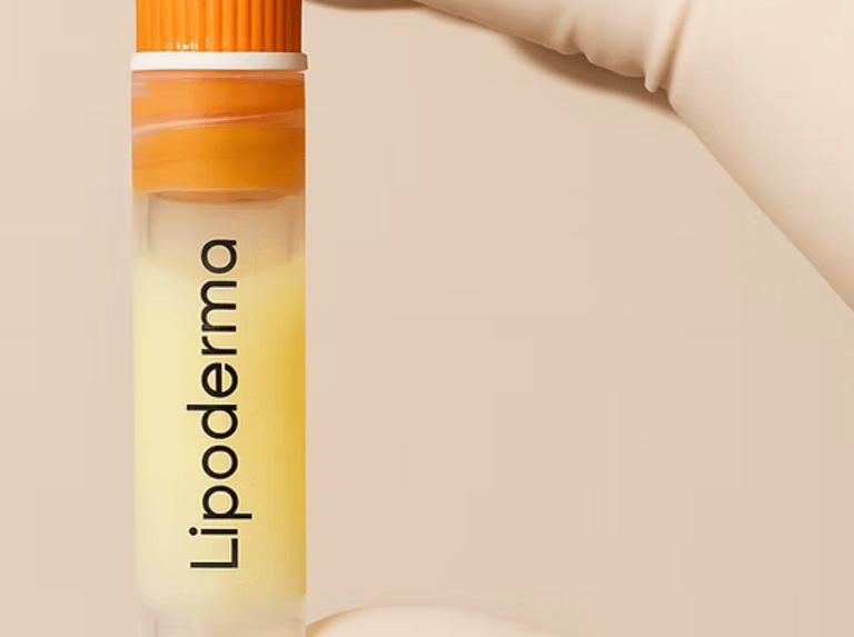 Cadaver derived Fat injections