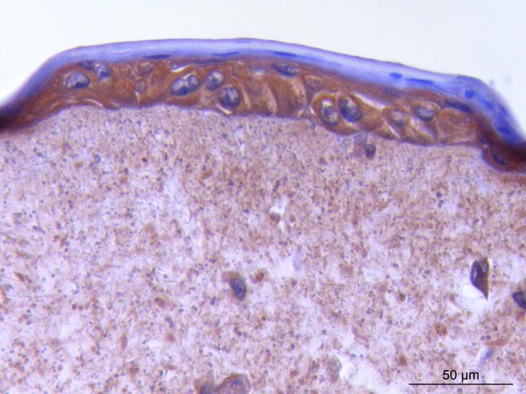 Microscopic view of skin tissue cross-section with epidermis and dermis layers at 50 micrometers.