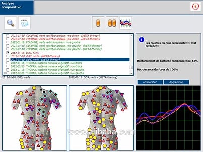 un écran d'ordinateur