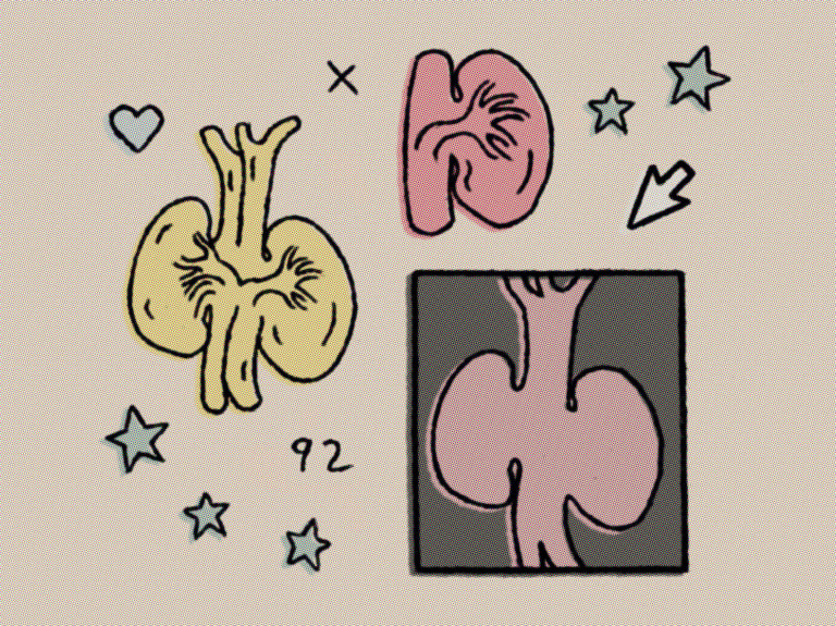 Rough halftoned digital art in comic style with pop art colors kidneys code arrow and stars hearts