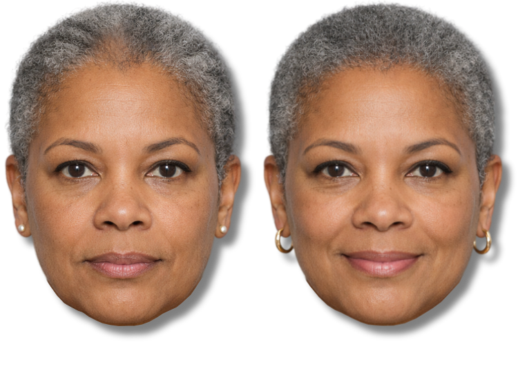 Before and after comparison of a woman showing improved hair density results.