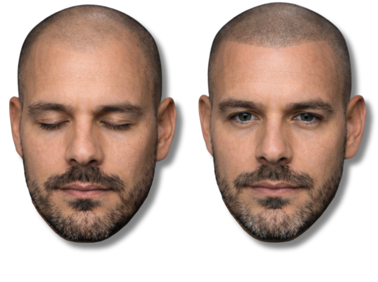 Before and after scalp micropigmentation for men showing a natural hairline and thicker hair appearance.