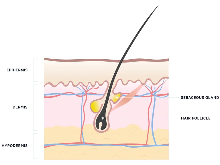 hair follicle singapore aesthetic clinic acne management