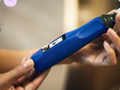 blue microneedling pen used for treatments