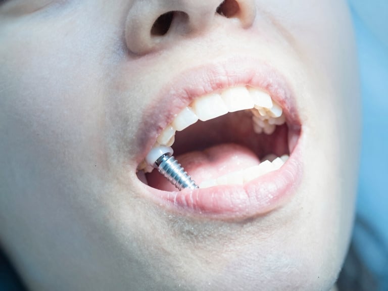 Close-up of a patient's mouth showing a dental implant being placed, advanced sterile clinical setting, bright high-key natural daylight, soft whites and calming blue tones, sharp focus, 35mm.