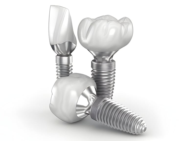 Single Tooth Dental Implant Cost and Procedure in Hyderabad