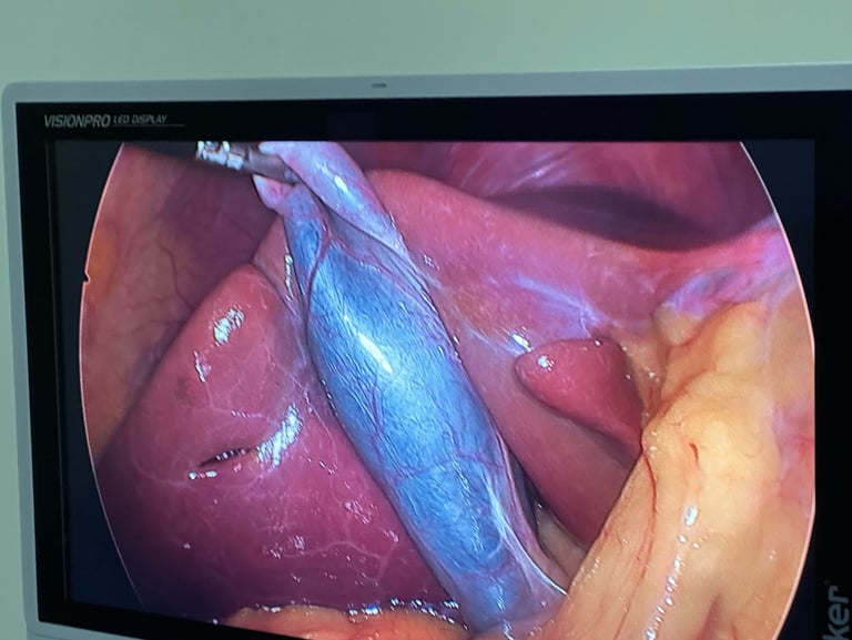 imagem da camera de videolaparoscopia