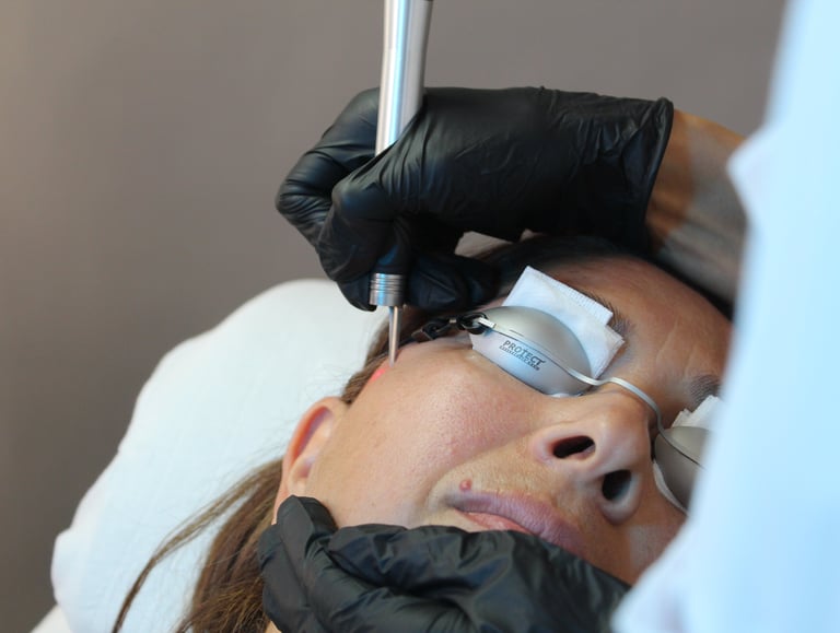 Kvinde får behandling med Glass Skin laser.