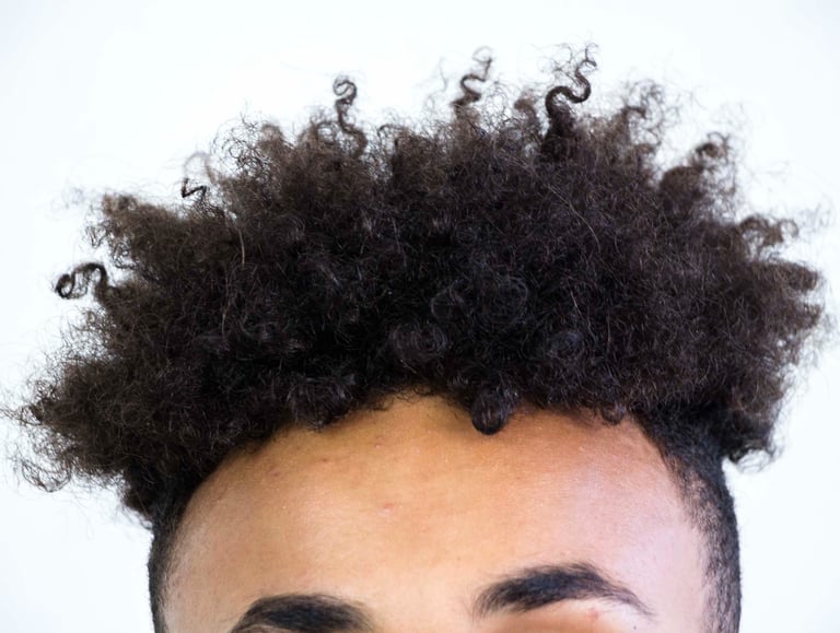 Top of the young men's forehead and top of his head with a spiky curly hairdo. 