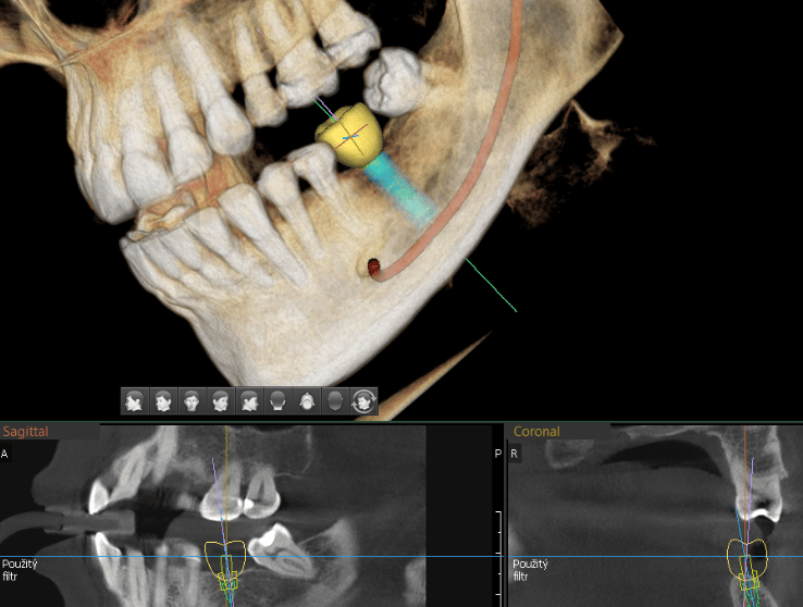 mouans-sartoux dentiste
