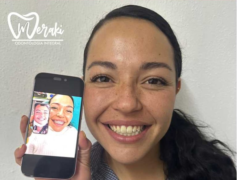 Mujer sonriente mostrando en teléfono los resultados del antes y después de tratamiento de brackets