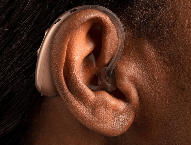 Audiologia pachua