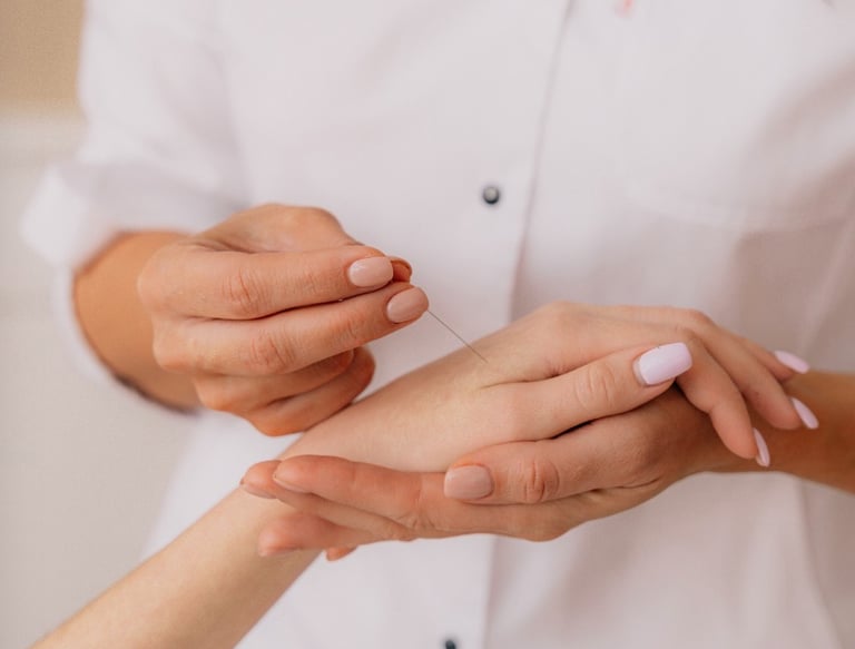 Close-up of a practitioner performing hand acupuncture therapy for holistic pain relief.