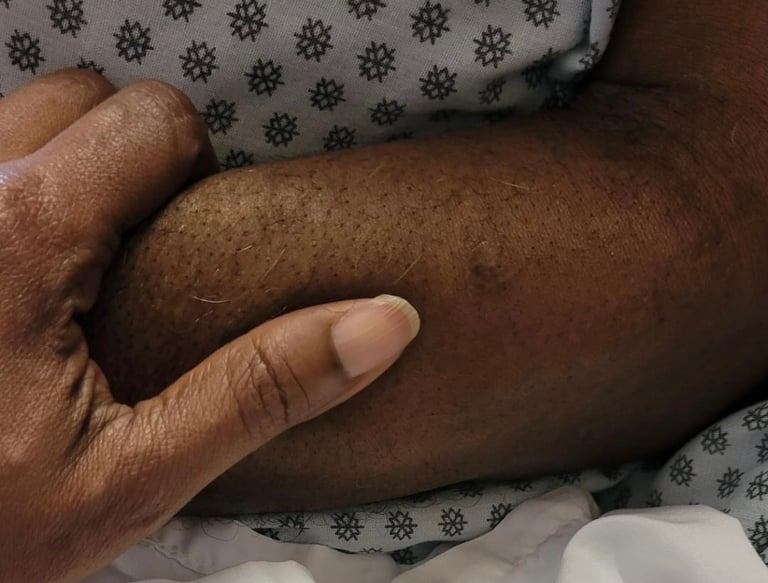 Photo of a patients arm being held by a hand.