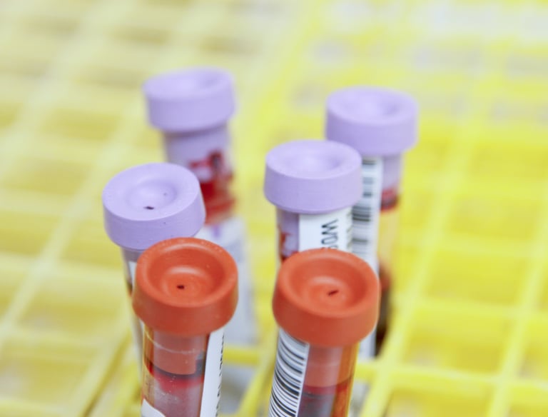 Exames de sangue
