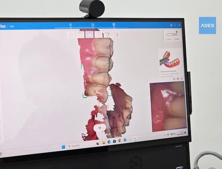 escáner intraoral 3D