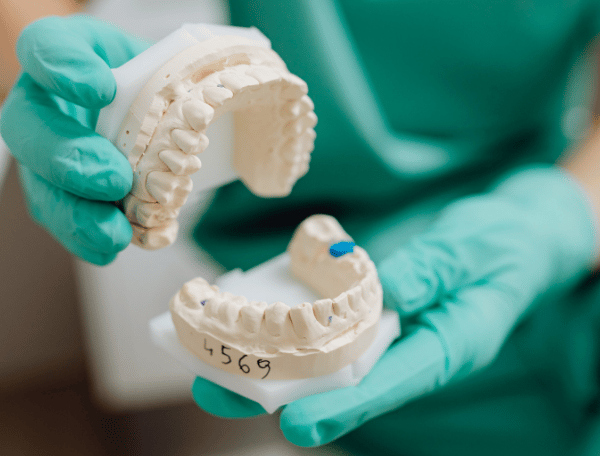 زراعة الأسنان - عيادة طب الاسنان دكتور وسام علي العباسي