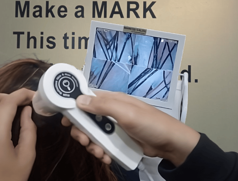 Hair Scalp Analysis