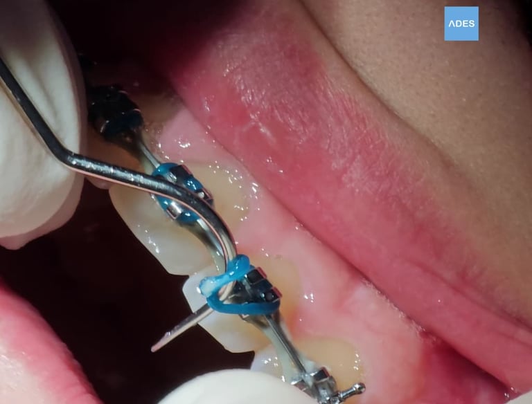revision ortodoncia clinica dental ades