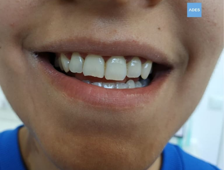 clinica dental ades ortodoncia infantil
