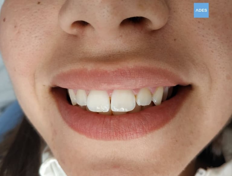 Ortodoncia infantil clinica dental ades