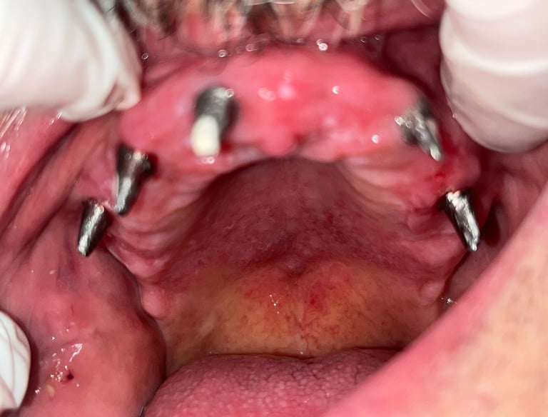 a close up of a person's mouth with a toothbrush