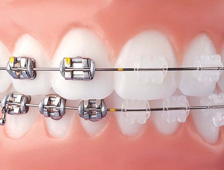 orthodontic braces baner