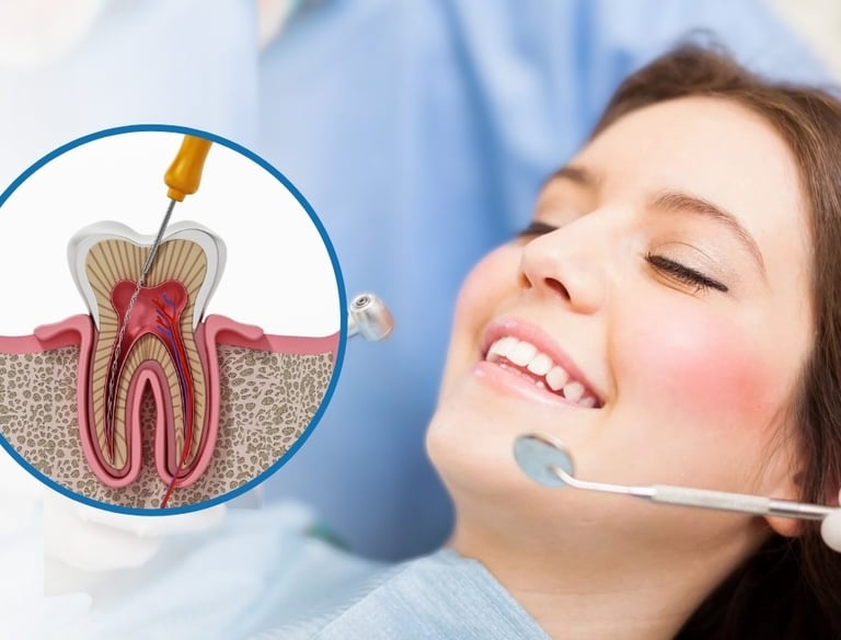 root canal treatment in baner