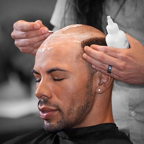 Scalp Micropigmentation in Toronto_ATRUBARBER Scalp Micropigmentation Studio
