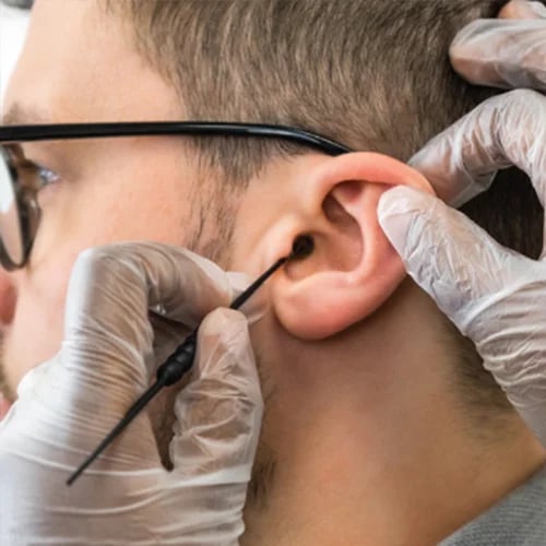 a man having earwax removed with a Jobson Horne probe